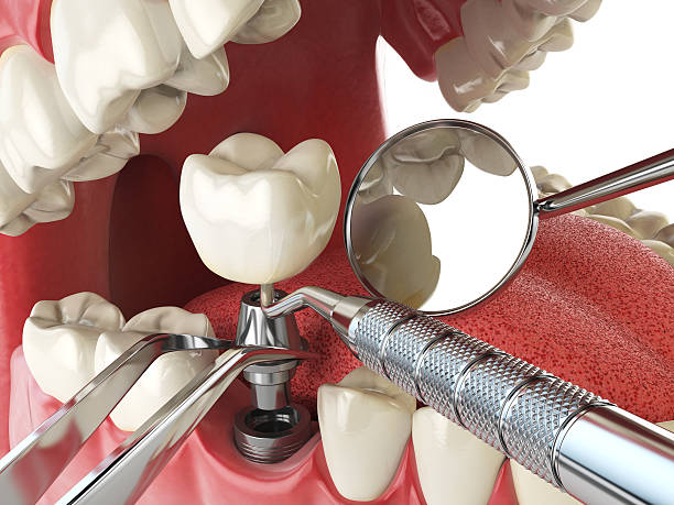 Best Emergency Gum Treatment in Yardville, NJ